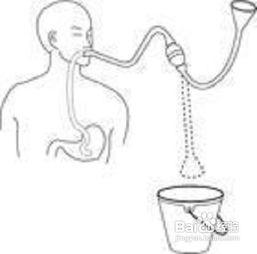 插胃管操作视频,步骤与技巧全解析